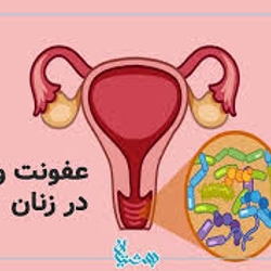 علت عفونت واژن در خانم های کارمند